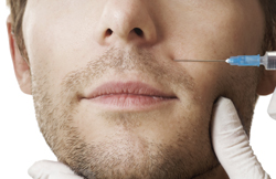 Dermal fillers smooth away "smile lines."